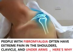 How Common Is Clavicle or Shoulder Pain in Fibromyalgia?