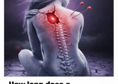 How Long Does a Fibromyalgia Attack or Crisis Last? A Complete, Compassionate Guide