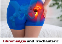 Trochanteric Bursitis and Fibromyalgia: Understanding the Link Behind Chronic Hip Pain