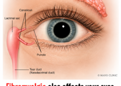 Why does fibromyalgia affect the eyes?